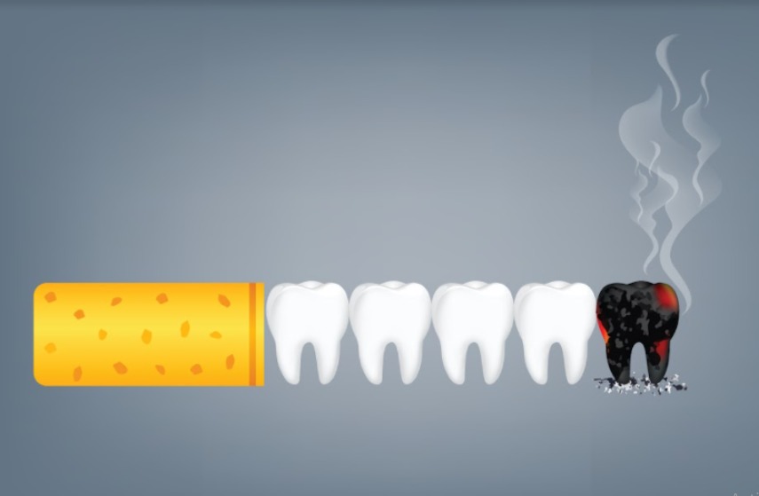 How Smoking Affects Your Teeth and Gums: What You Should Know