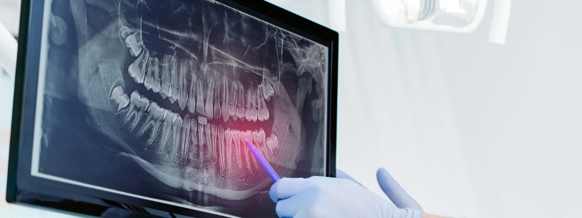 Why do we as dentists take an X-ray?