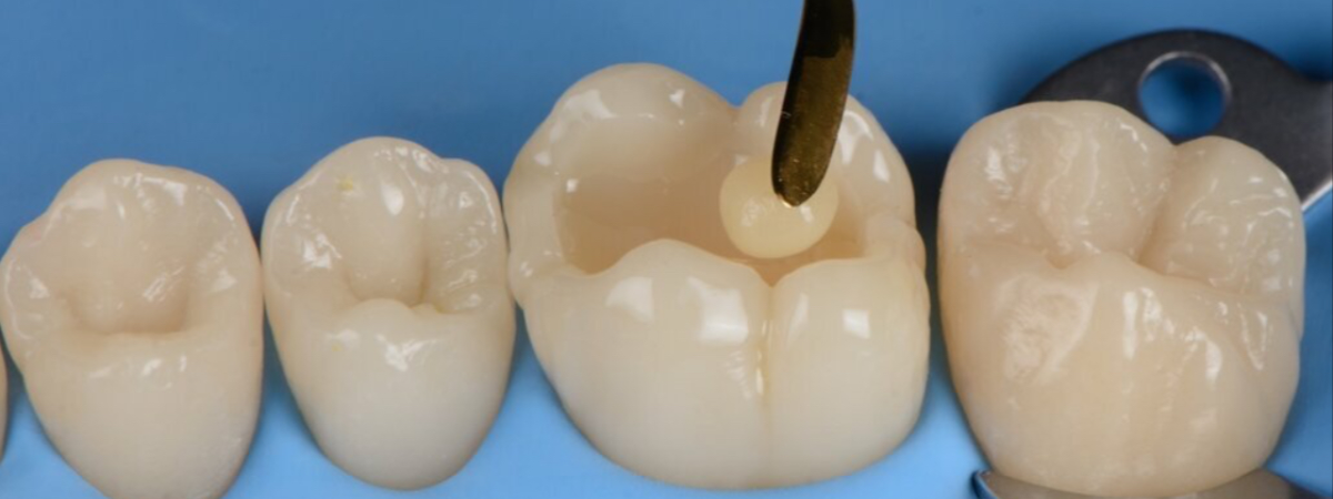 Adhesive & Biomimetic Dentistry: The Future of Saving Teeth