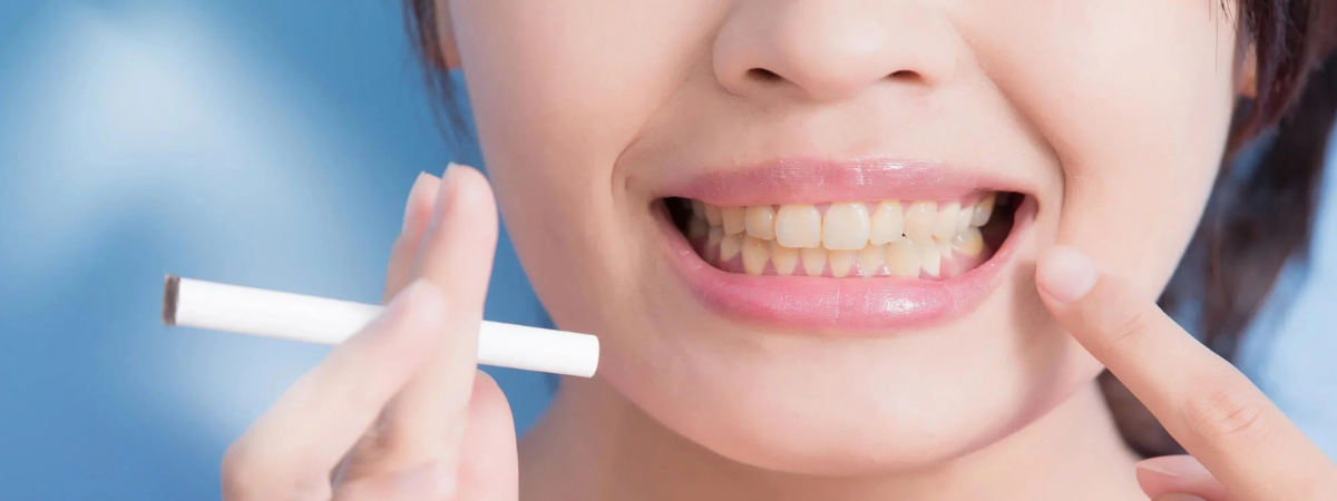 How Smoking Affects Your Teeth and Gums: What You Should Know