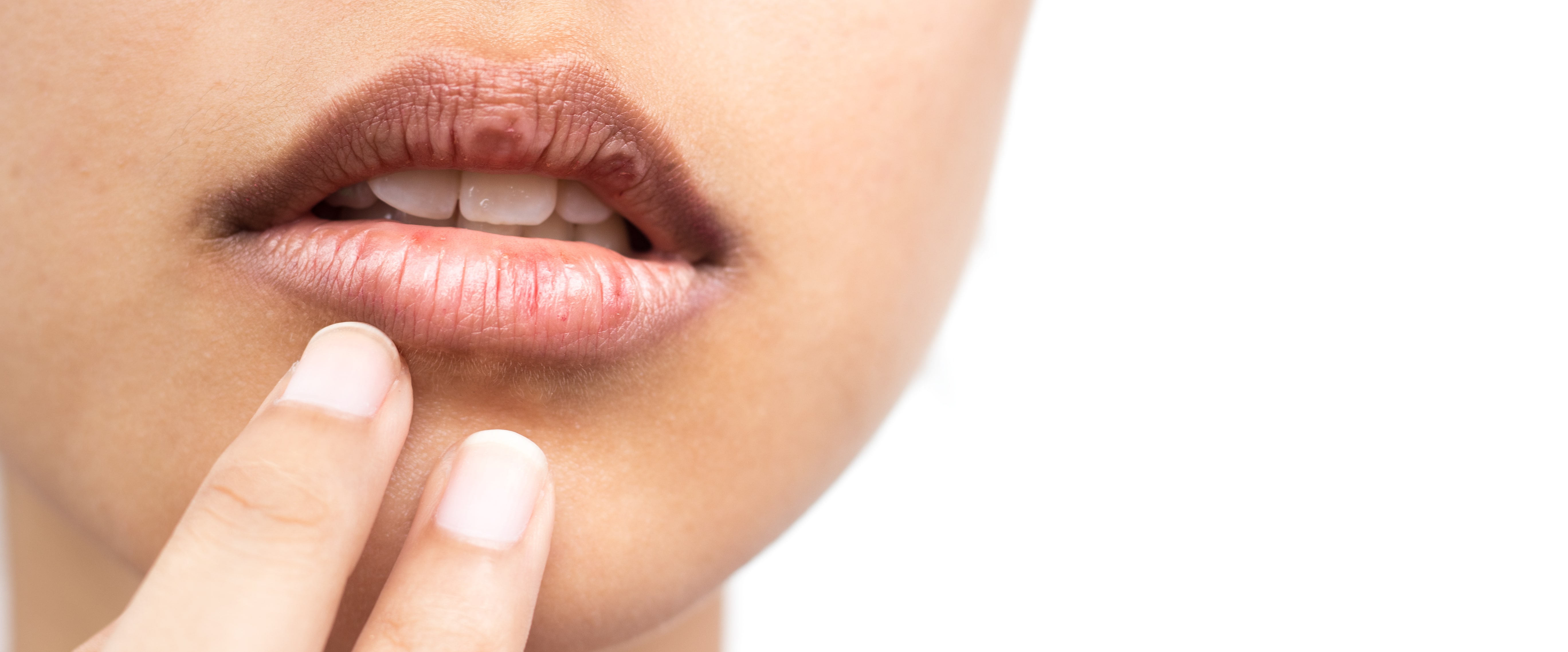 Dry Mouth (Xerostomia): Causes, Symptoms & Treatment | Julphar Dental Clinic