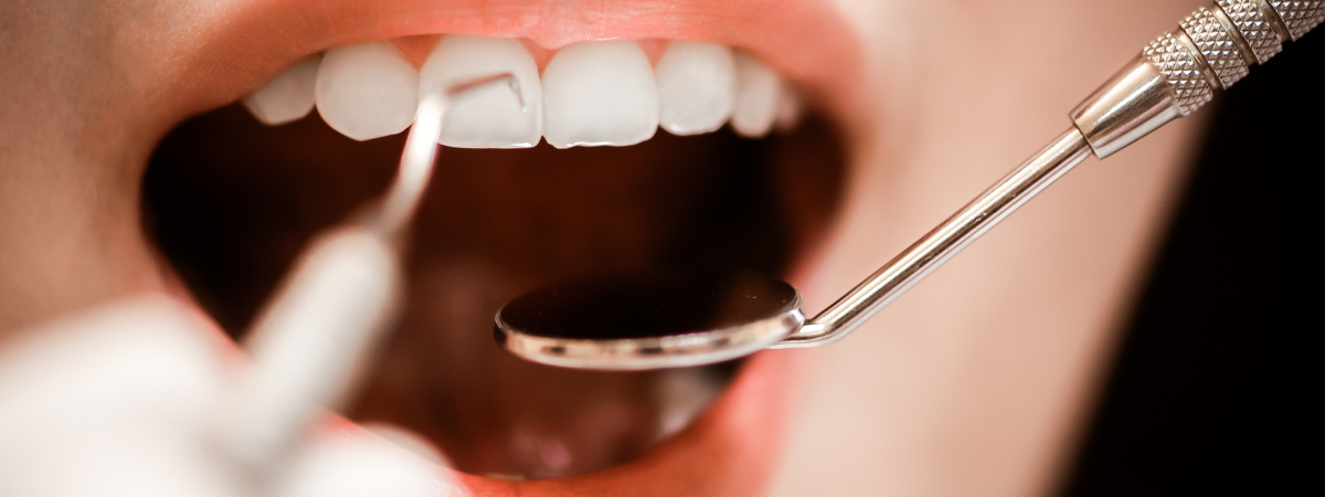 Internal Tooth Resorption: Causes, Symptoms & Treatment