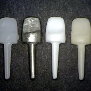 Dental Post 2